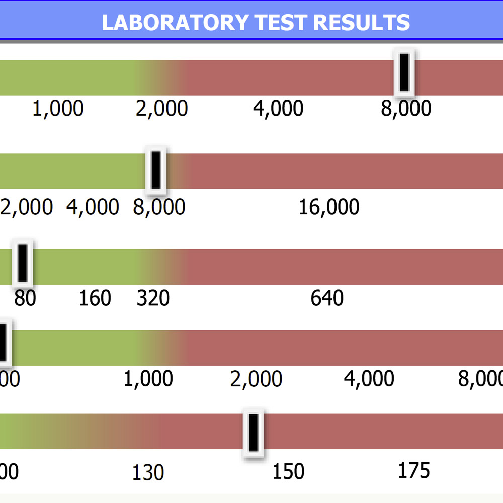 Autoimmune Brain Panel Sample Test