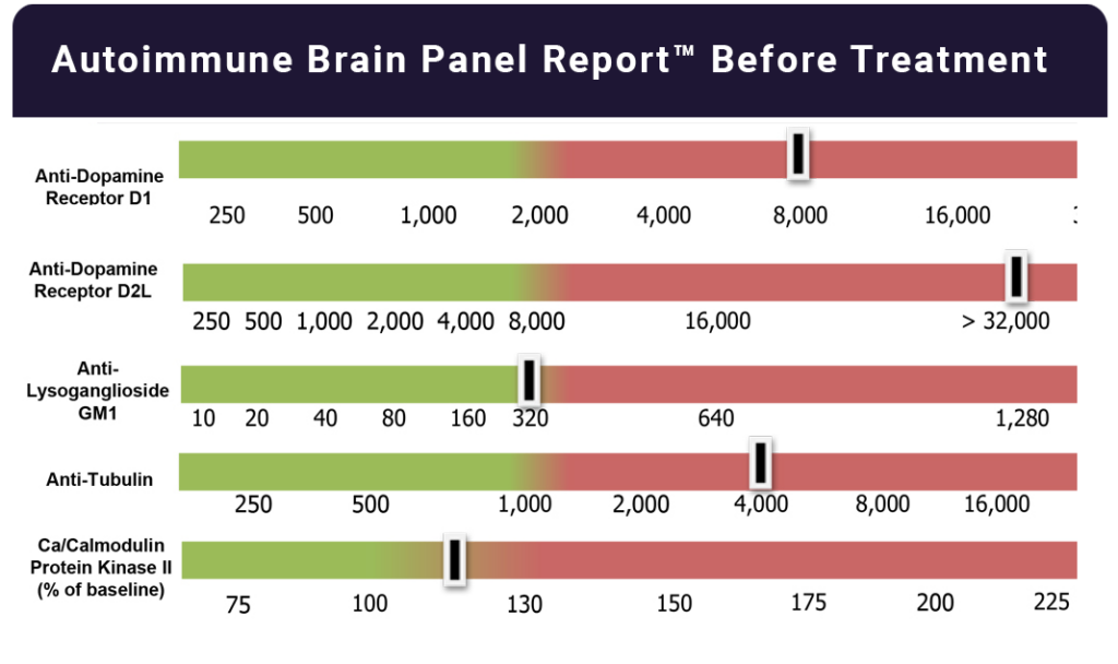 Brain Panel before Treatment